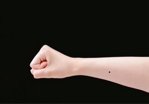 （李向东）手臂上长痣代表什么-科学探索