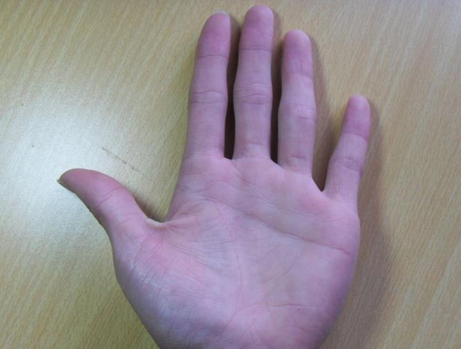 手掌与健康度联系的文章，你了解多少？